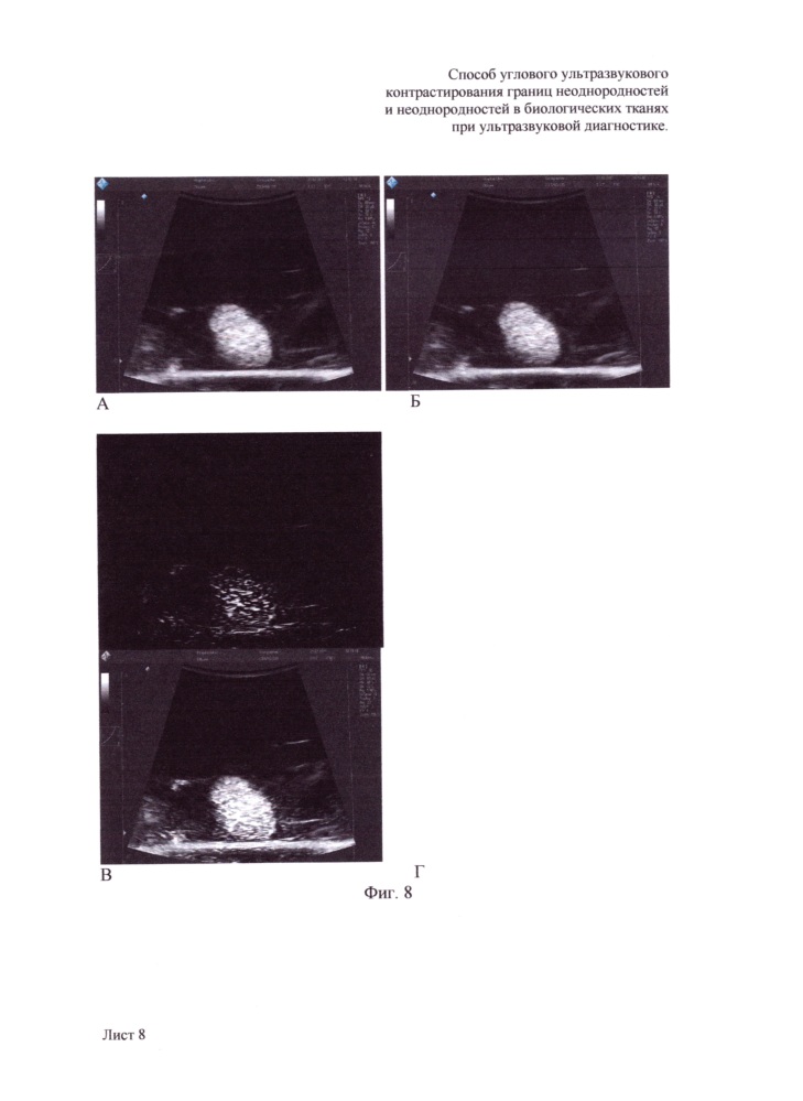 Способ углового ультразвукового контрастирования границ неоднородностей и неоднородностей в биологических тканях при ультразвуковой диагностике (патент 2648880)