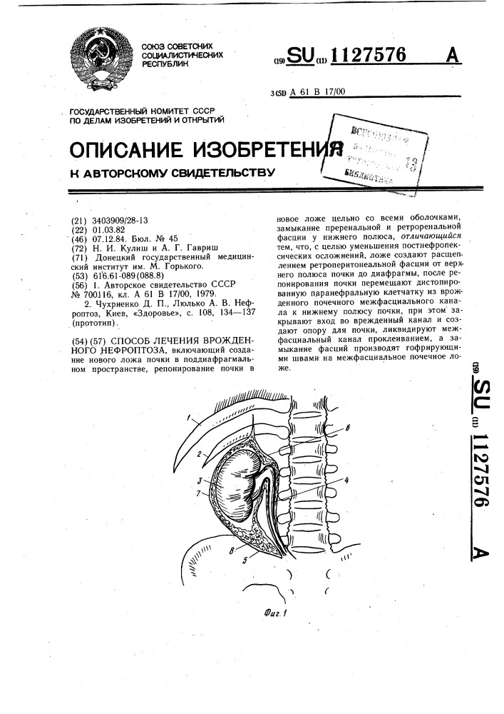 Способ лечения врожденного нефроптоза (патент 1127576)