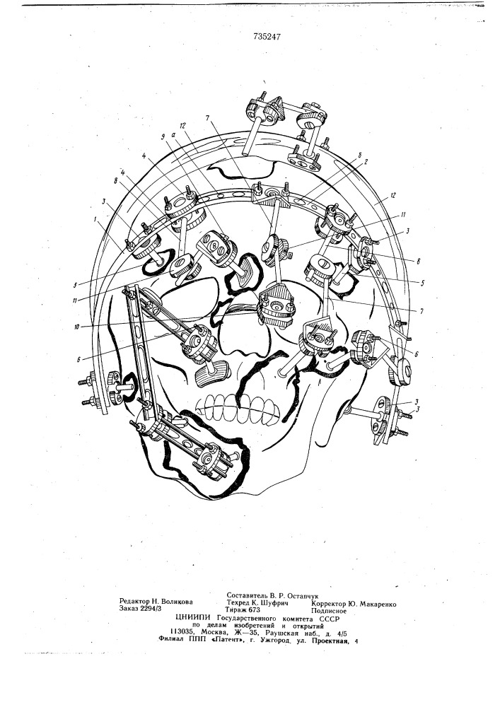 Устройство для лечения переломов черепа (патент 735247)
