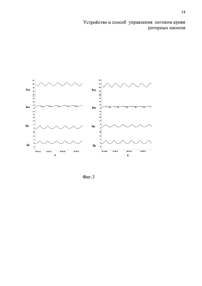 Устройство и способ управления потоком крови роторных насосов (патент 2665178)