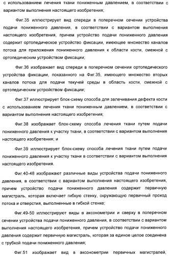 Устройство для лечения путем подкожной подачи пониженного давления с использованием разделения с помощью воздушного баллона (патент 2401652)