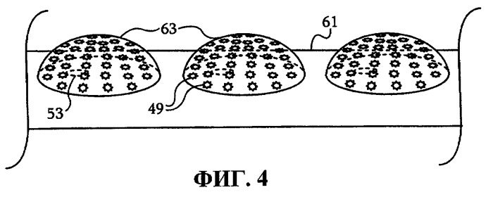 Двухцелевой катетер лассо с ирригацией (патент 2526964)