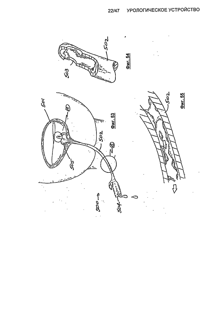 Урологическое устройство (патент 2600865)