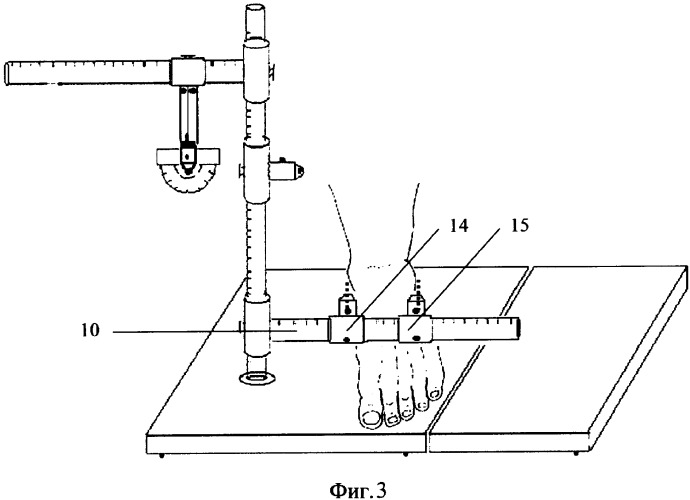 Устройство для измерения размеров голеностопного сустава и стопы (патент 2325108)