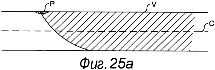 Катетер (патент 2457871)