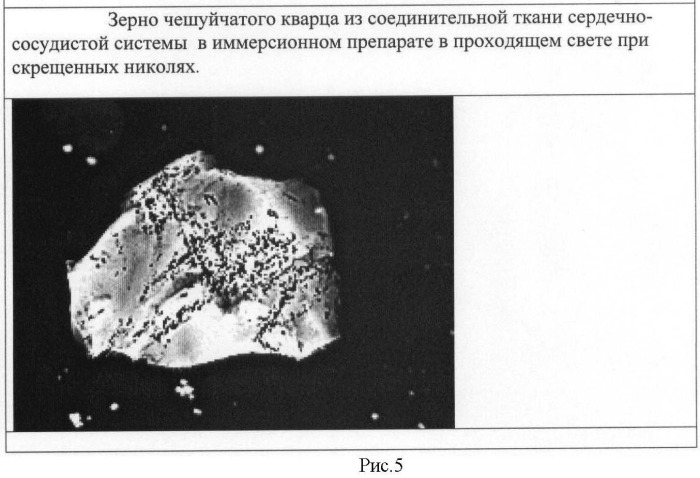 Способ выделения минералов в соединительной ткани человека методом низкотемпературного озоления ткани (патент 2463594)