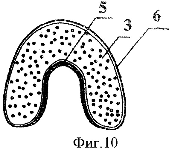Съемный протез куретовых на беззубую нижнюю и верхнюю челюсти с посадочным местом для альвеолярного гребня и твердого неба (патент 2462211)