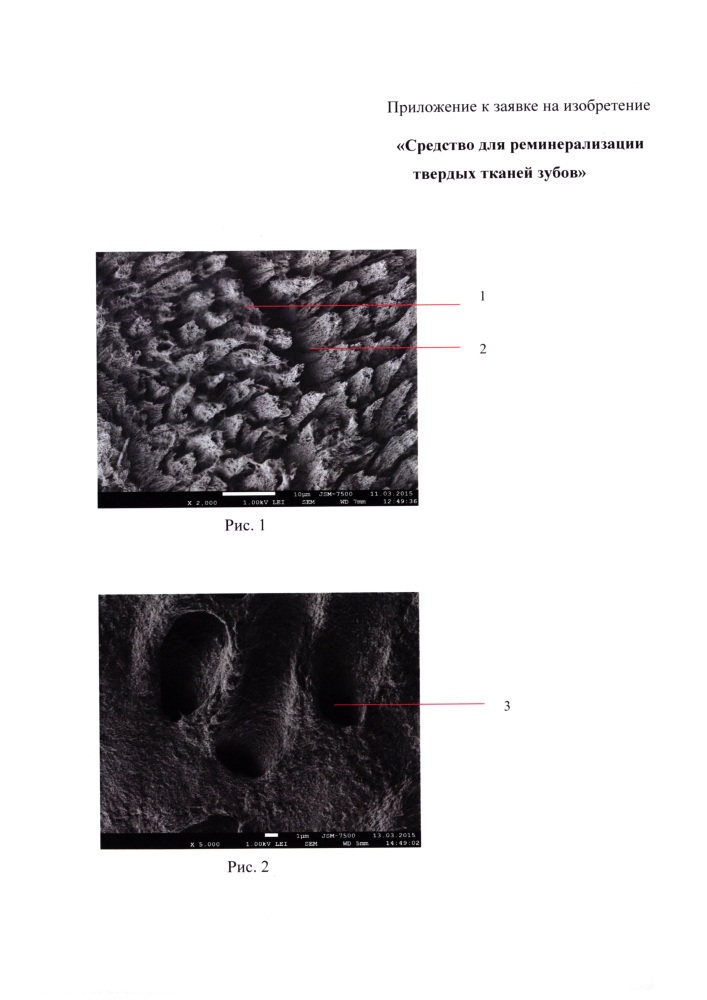 Средство для реминерализации твердых тканей зубов (патент 2627624)