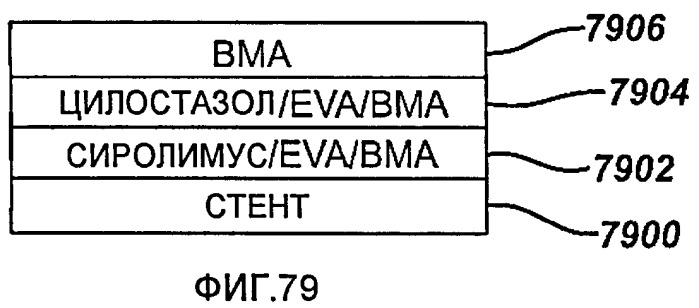 Устройство для локальной и/или регионарной доставки с применением жидких составов терапевтически активных веществ (патент 2513153)