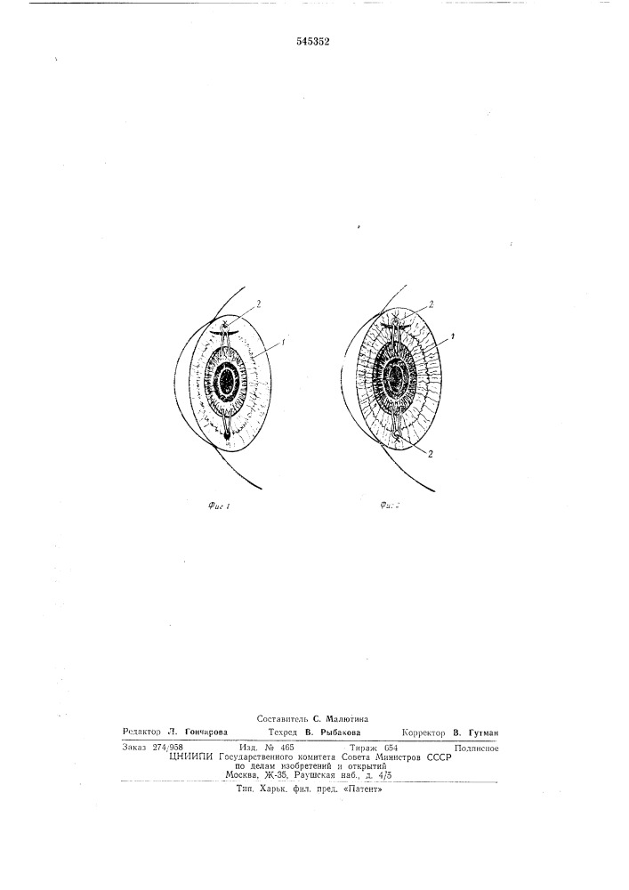 Искусственный хрусталик (патент 545352)