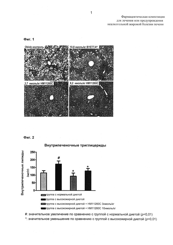 Фармацевтическая композиция для предупреждения или лечения неалкогольной жировой болезни печени (патент 2635966)