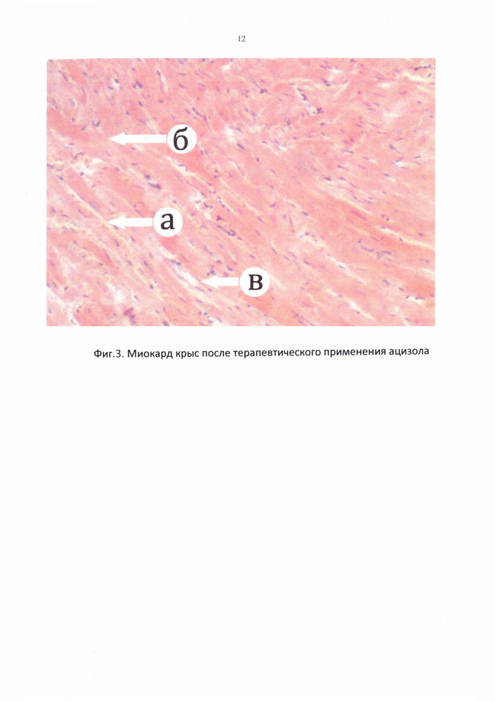 Способ лечения экспериментальной амилоидной кардиопатии у крыс (патент 2657844)