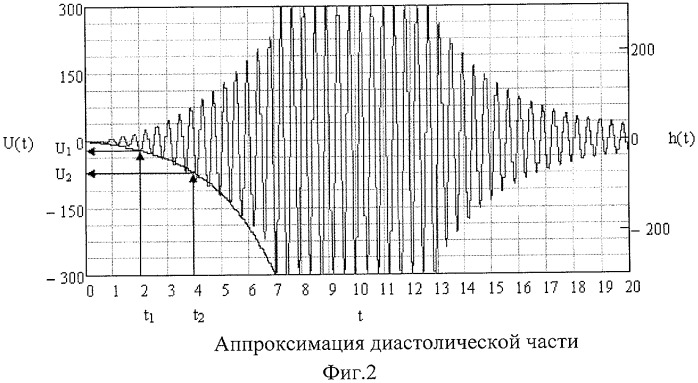 Способ измерения артериального давления (патент 2441581)