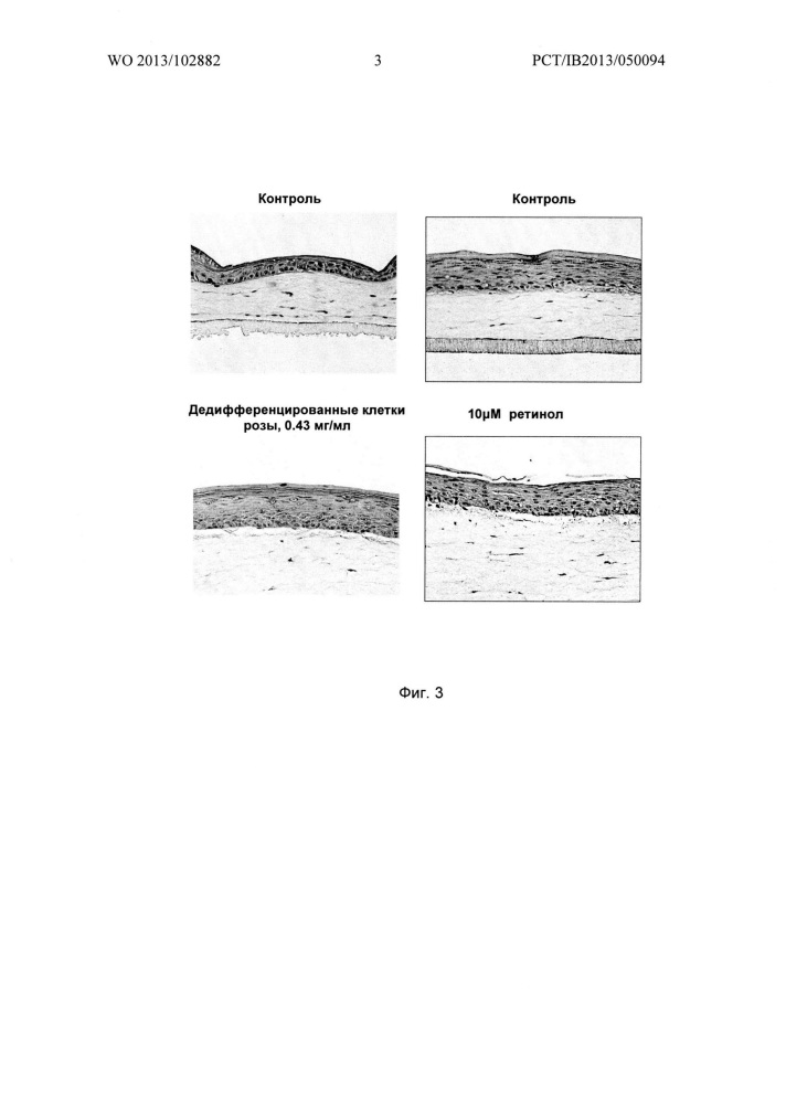 Косметическое применение дедифференцированных растительных клеток (патент 2636518)