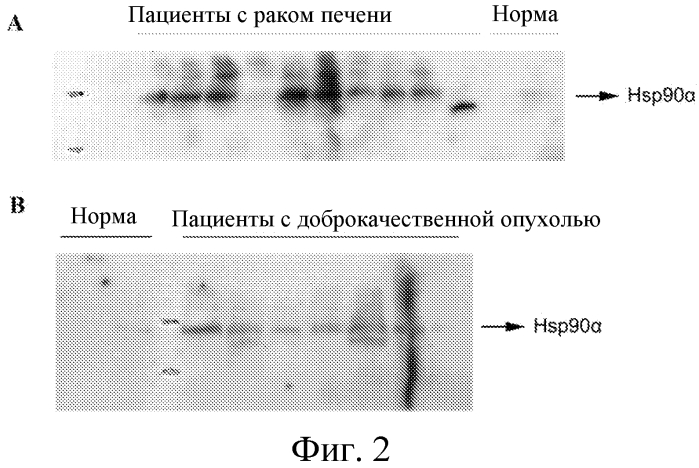 Новый опухолевый биомаркер (патент 2567005)