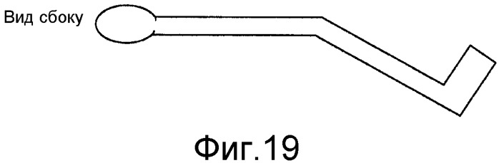 Коррекция стрессового недержания мочи (патент 2548825)