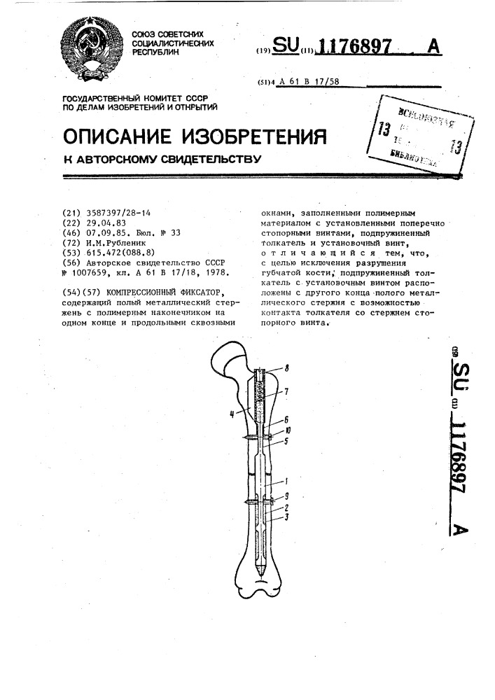 Компрессионный фиксатор (патент 1176897)