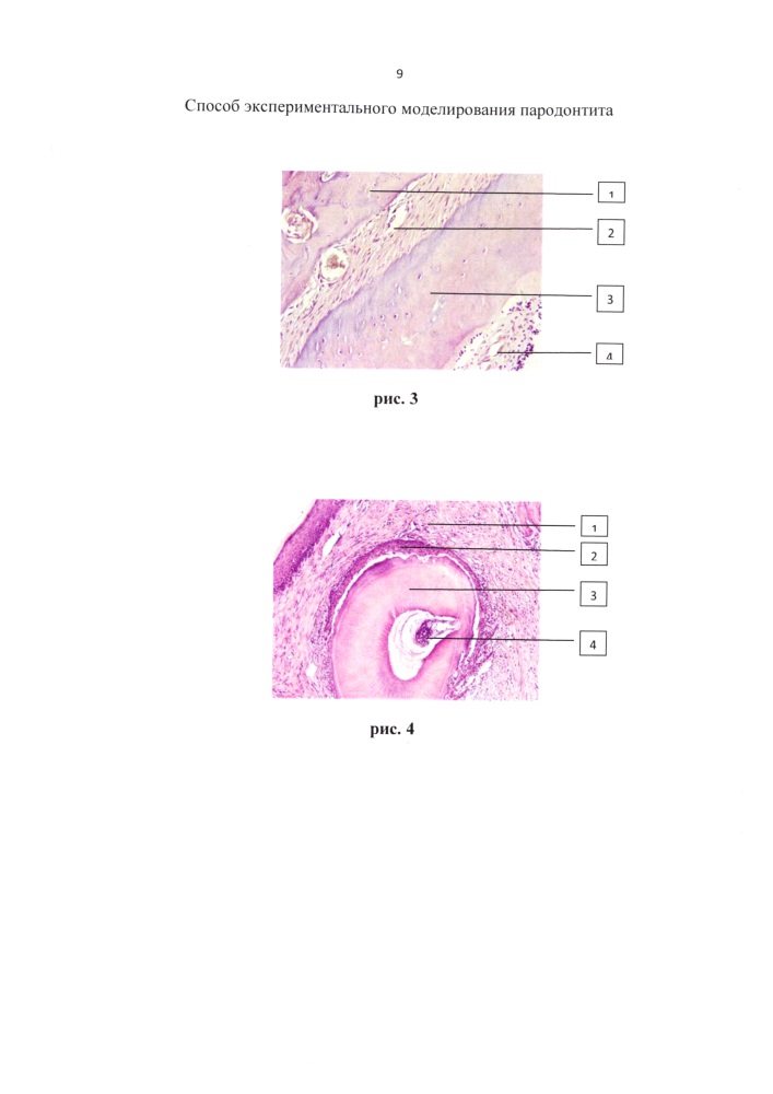 Способ экспериментального моделирования пародонтита (патент 2625295)