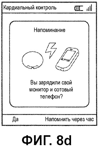 Система контроля экг с конфигурируемыми пределами включения сигналов тревоги (патент 2499550)