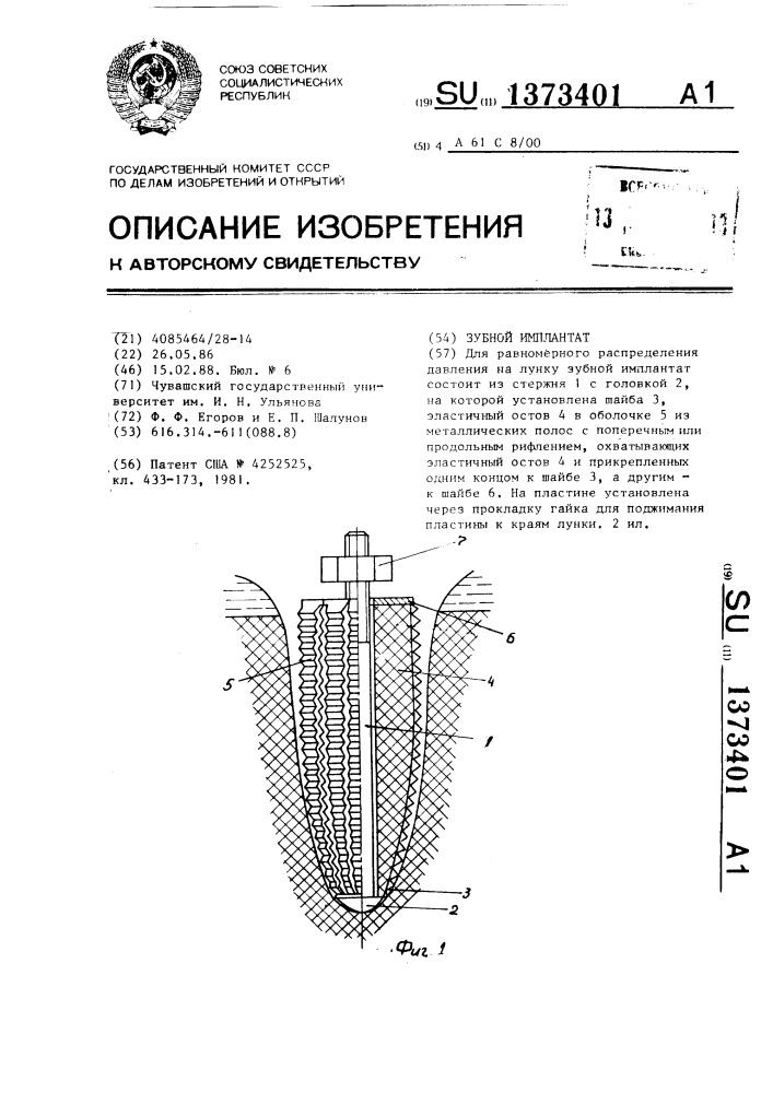 Зубной имплантат (патент 1373401)