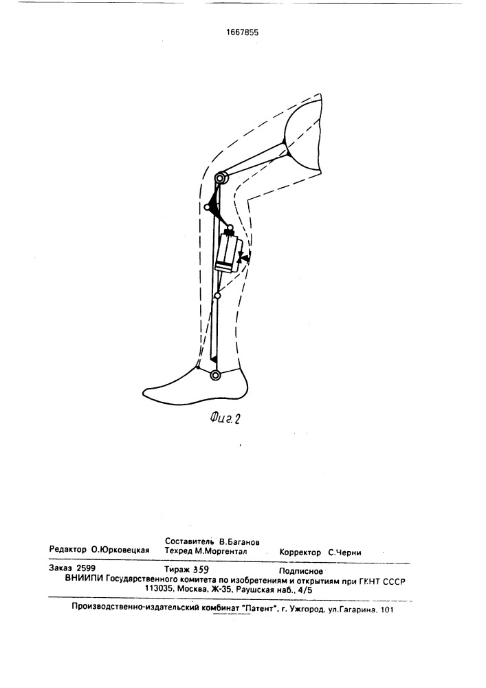 Протез нижней конечности (патент 1667855)