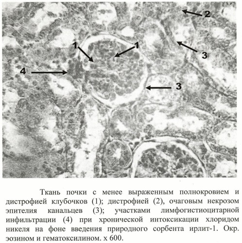 Способ профилактики токсического действия никеля у экспериментальных животных при хроническом отравлении (патент 2400824)