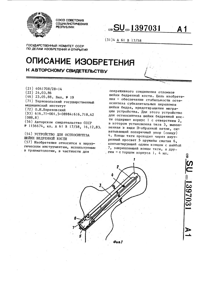 Устройство для остеосинтеза шейки бедренной кости (патент 1397031)