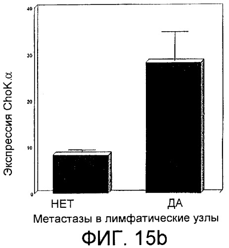 Способ in vitro определения прогноза развития заболевания у больного раком и способ in vitro мониторинга эффекта терапии, назначаемой больному раком (патент 2434946)