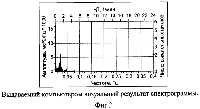 Способ функциональной предоперационной диагностики послеоперационных осложнений у пациентов после протезирующей герниопластики по поводу послеоперационных грыж (патент 2491885)