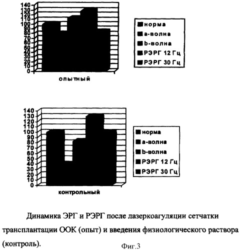 Способ повышения функциональной активности сетчатки при ее патологии различного генеза (патент 2364382)