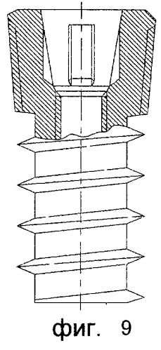 Стоматологический имплантат (патент 2262324)