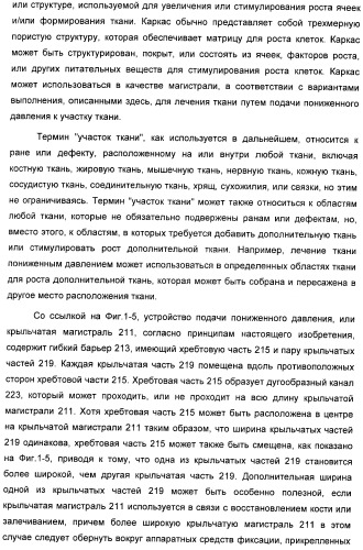 Система и способ продувки устройства пониженного давления во время лечения путем подачи пониженного давления (патент 2404822)