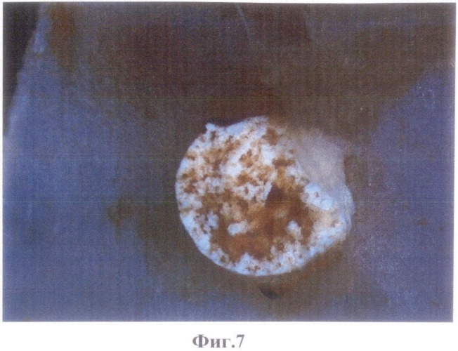 Композиционный костно-керамический имплантат на основе керамического материала системы оксид циркония - оксид алюминия (патент 2542496)