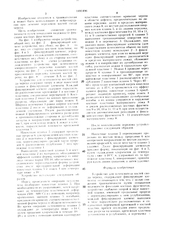 Устройство для остеосинтеза костей свода черепа (патент 1491496)