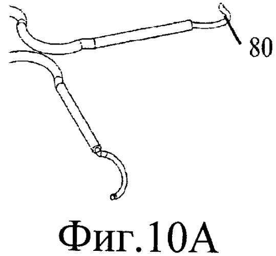 Ирис-ретрактор (патент 2564074)