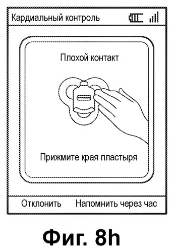 Система контроля экг с беспроводной связью (патент 2501520)