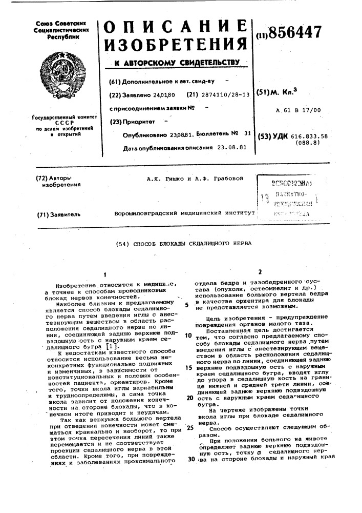 Способ блокады седалищного нерва (патент 856447)
