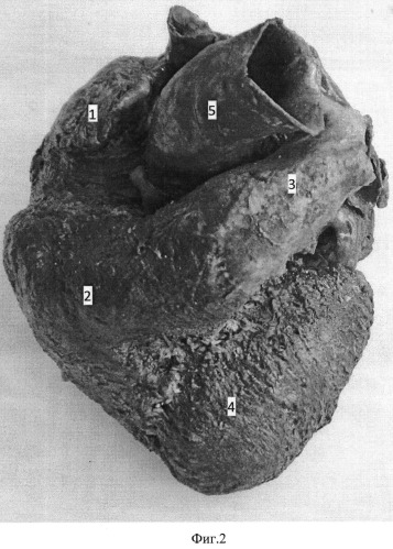 Способ изготовления сухого анатомического препарата сердца (патент 2547792)
