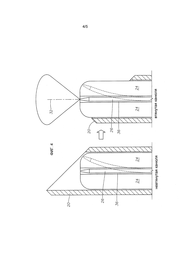 Офтальмологические эндоиллюминаторы с направленным светом (патент 2622446)