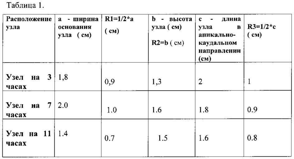 Способ лечения внутренних геморроидальных узлов (патент 2620755)