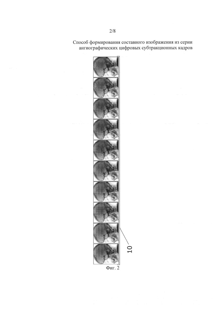 Способ формирования составного изображения из серии ангиографических цифровых субтракционных кадров (патент 2633949)