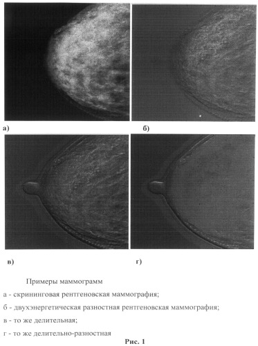 Способ двухэнергетической делительно-разностной маммографии (патент 2495623)