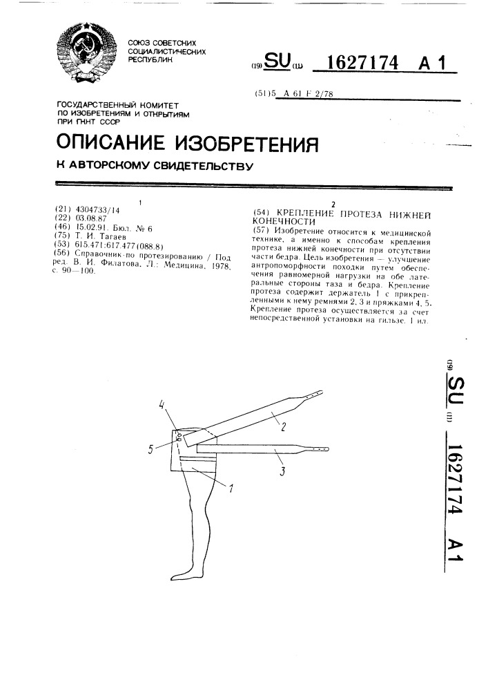 Крепление протеза нижней конечности (патент 1627174)