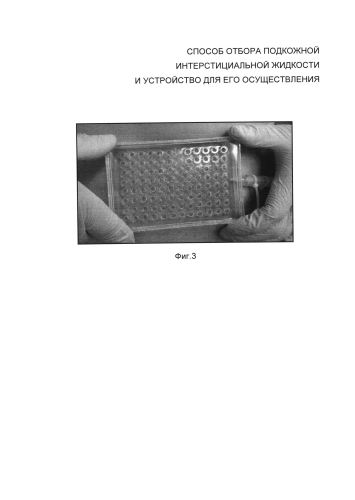 Способ отбора подкожной интерстициальной жидкости и устройство для его осуществления (патент 2581712)