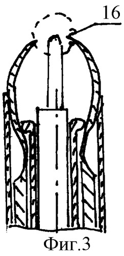 Устройство для лапароскопического удаления камней из желчного пузыря (патент 2340297)