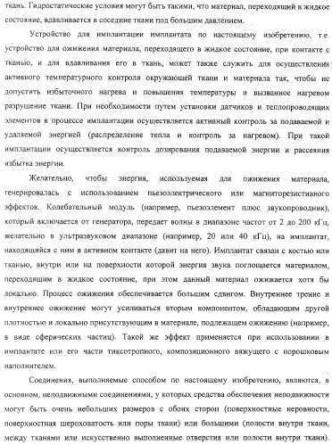 Имплантаты для создания соединений с тканями, в частности со скелетом, а также устройство и способ имплантации (патент 2314768)