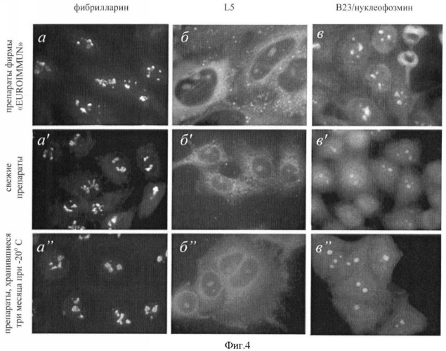 Способ фиксации клеток человека hela и hep-2 для иммуноцитохимического выявления ядерных аутоантигенов (патент 2362583)