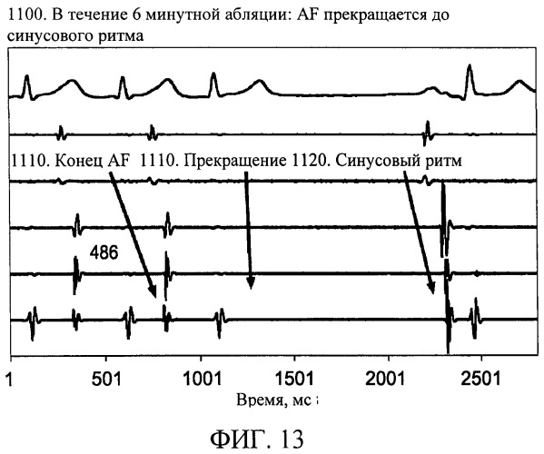 Способы, система и устройство для обнаружения, диагностики и лечения нарушений биологического ритма (патент 2559639)