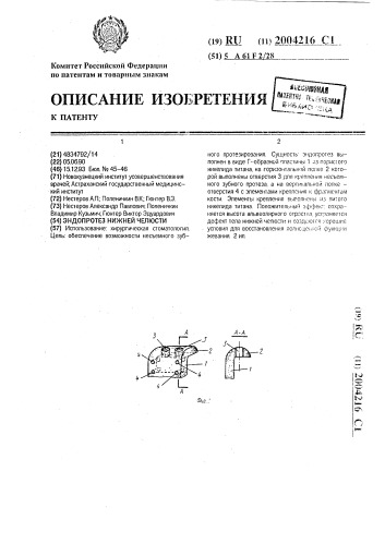 Эндопротез нижней челюсти (патент 2004216)