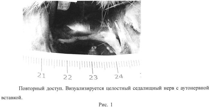 Кодон-оптимизированная рекомбинантная плазмида, способ стимуляции регенерации периферического нерва, способ лечения поврежденного нерва человека (патент 2558294)